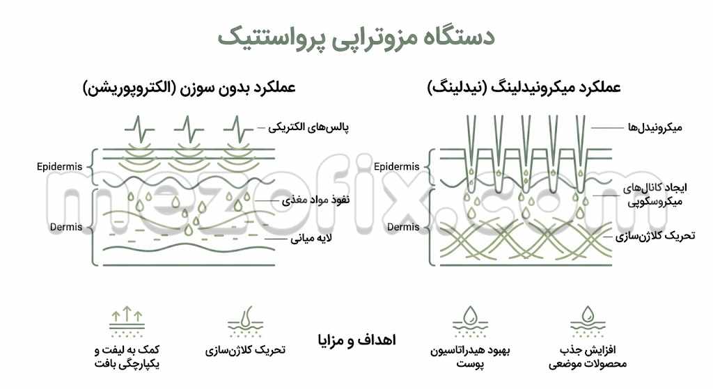 دستگاه مزوتراپی پرواستتیک چیست؟