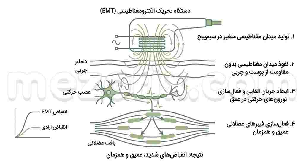 میدان الکترومغناطیسی دستگاه emt چگونه عضلات را تحریک می کند ؟