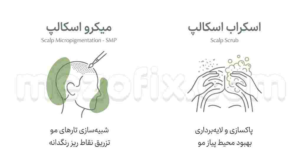 میکرو اسکالپ و اسکراب اسکالپ؛ از اصول تا کاربردهای عملی