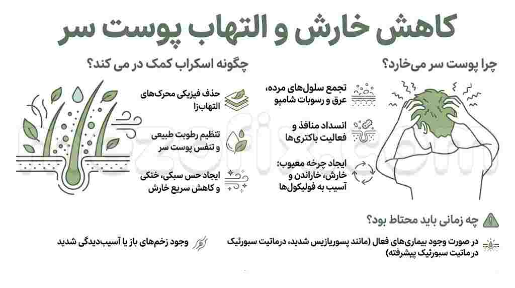 کاهش خارش و التهاب پوست سر